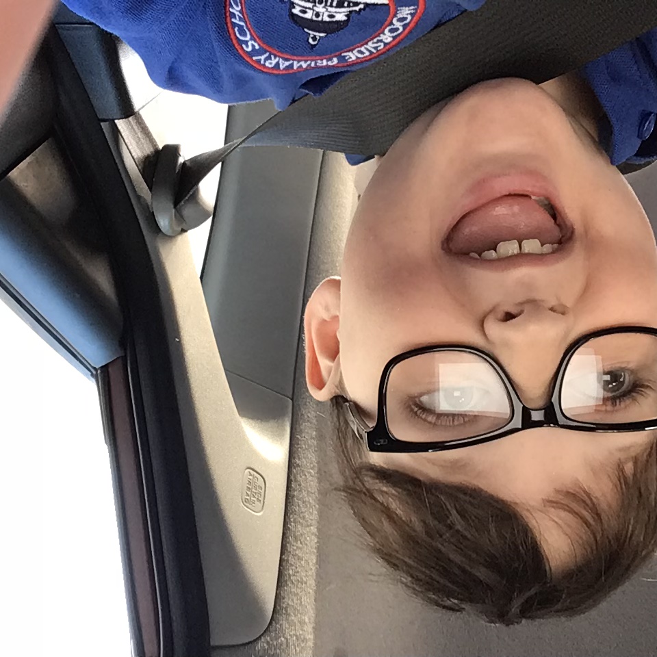 Ben’s funny face